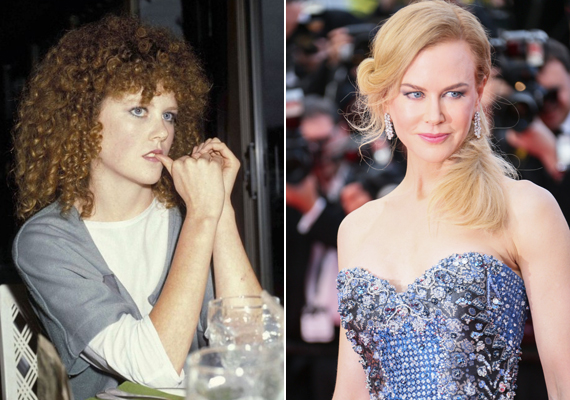Nicole Kidman göndör, vörös hajával és festetlenül úgy nézett ki, mint bármelyik átlagos nő. A stílusában bekövetkezett változást Tom Cruise-zal kötött házassága hozta, illetve az A-kategóriás színésznők közé kerülése. Még a sok plasztikai műtét ellenére is nagyon szép nő.