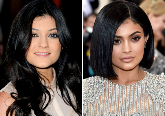 Kylie Jenner az egyik, akinek arca már csak nyomokban hasonlít a korábbira, annak ellenére, hogy a lány mindössze 18 éves. Hajszíne nem változott, de szája, orra és álla plasztikázott, sminkje pedig erős és megtévesztő a rafinált kontúrozás miatt.